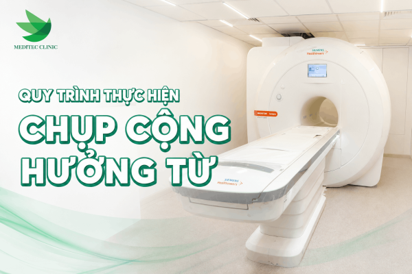 quy trình thực hiện chụp cộng hưởng từ là gì