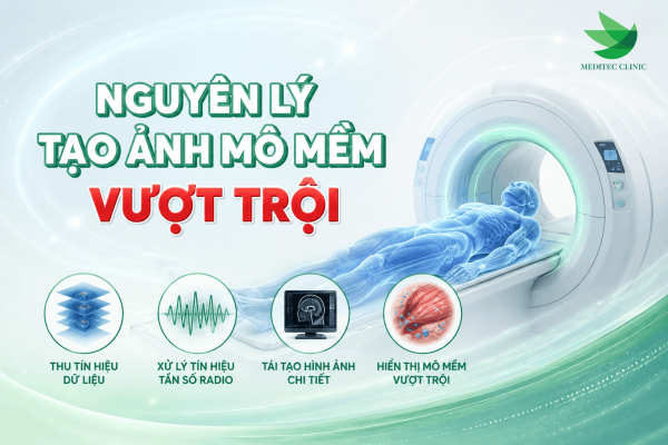 Nguyên lý chụp cộng hưởng từ là gì
