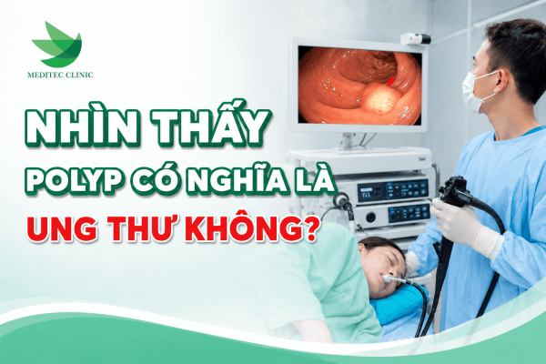 Nhìn thấy polyp có nghĩa là ung thư không?