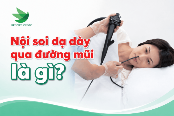 Nội soi dạ dày qua đường mũi là gì?