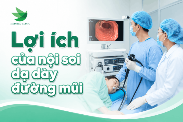lợi ích của nội soi dạ dày đường mũi