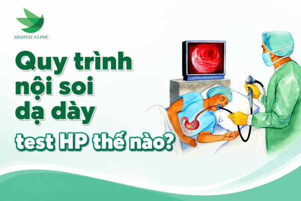 Quy trình nội soi dạ dày test HP thế nào?