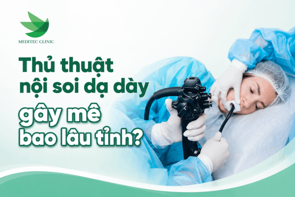 Thủ thuật nội soi dạ dày gây mê bao lâu tỉnh?