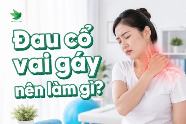 đau cổ vai gáy nên làm gì với 7 bước xử trí ban đầu