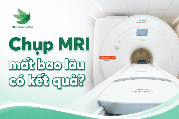 Chụp MRI mất bao lâu có kết quả trong thực tế?