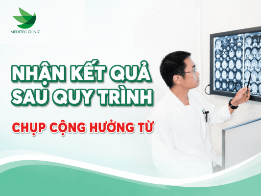 Nhận kết quả thế nào sau quy trình chụp cộng hưởng từ MRI?