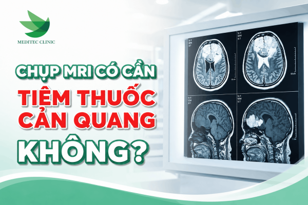 Chụp MRI có cần tiêm thuốc cản quang không?