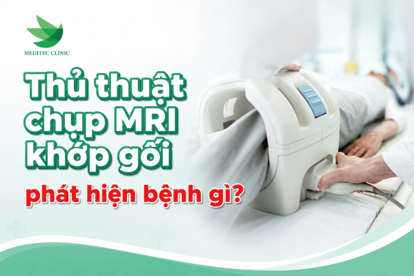 Thủ thuật chụp MRI khớp gối phát hiện bệnh gì?