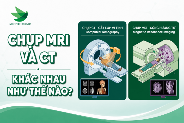 Bản chất chụp MRI và CT khác nhau như thế nào?
