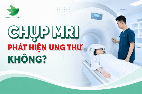 Chụp MRI có phát hiện ung thư không?