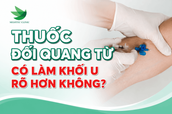 Thuốc đối quang từ có làm khối u rõ hơn không?