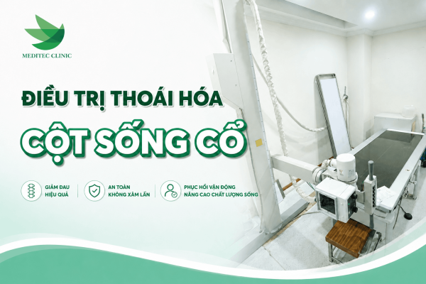 Điều trị khi thoái hóa cột sống cổ
