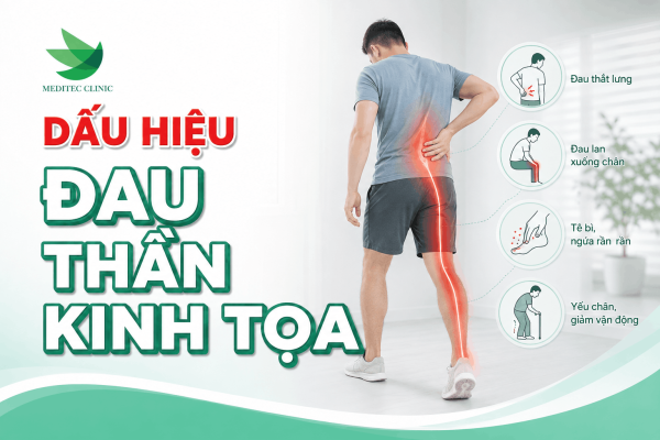Dấu hiệu đau thần kinh tọa theo nguyên nhân và mức độ