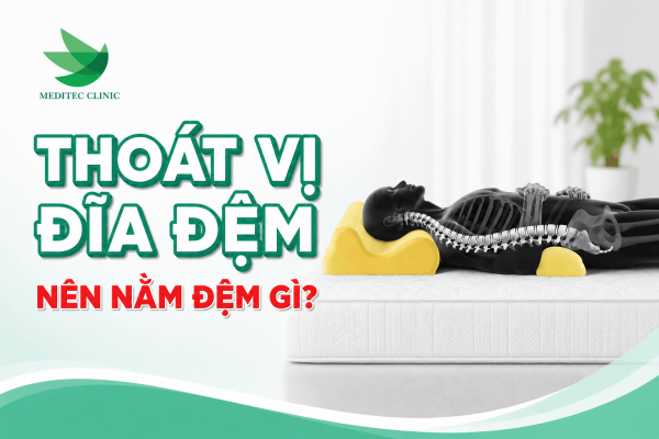 Thoát vị đĩa đệm nên nằm đệm gì?