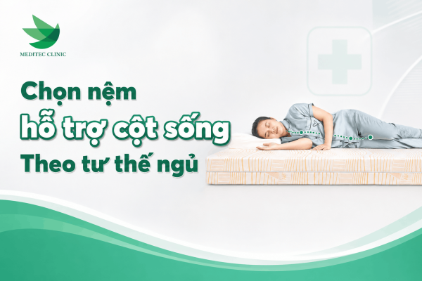 Chọn nệm hỗ trợ cột sống như thế nào theo tư thế ngủ cho người đau lưng?