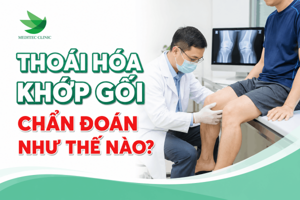 Thoái hóa khớp gối được chẩn đoán như thế nào?