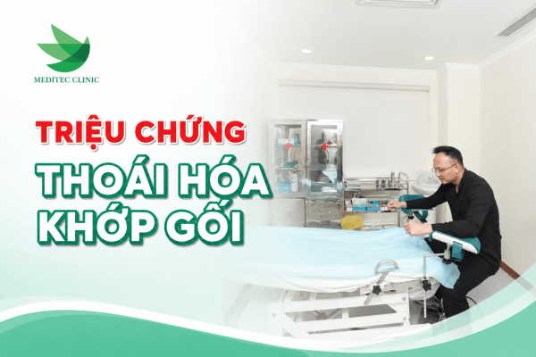 Triệu chứng thoái hóa khớp gối thay đổi theo mức độ ra sao?