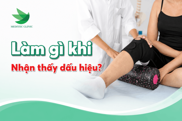 Làm gì khi nhận thấy dấu hiệu thoái hóa khớp gối?