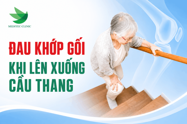 Đau khớp gối khi lên xuống cầu thang là dấu hiệu gì?