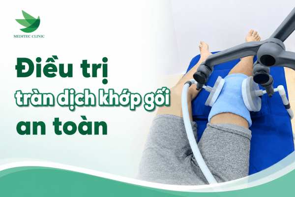 Điều trị tràn dịch khớp gối như nào cho an toàn?