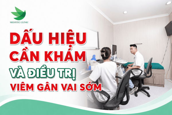 Dấu hiệu cần khám và điều trị viêm gân vai sớm
