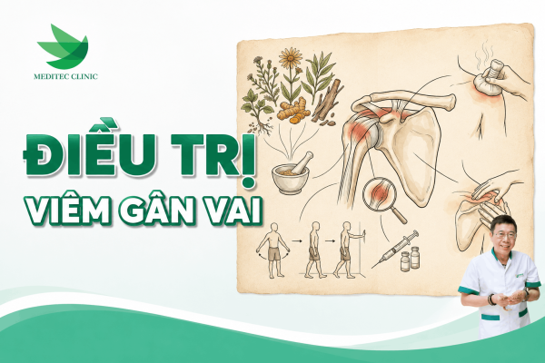 Điều trị viêm gân vai, phục hồi chức năng và các biện pháp phòng ngừa tái phát