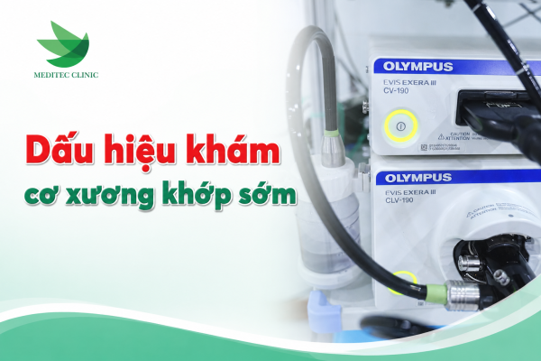 Dấu hiệu khám cơ xương khớp sớm thay vì đợi viêm khớp