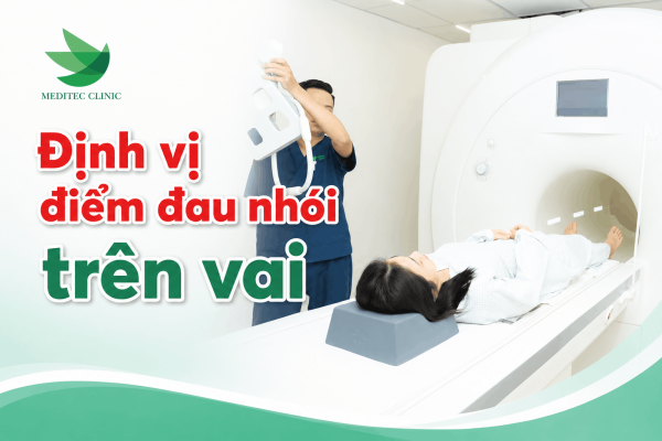 Chẩn đoán MRI: Định vị điểm đau nhói trên vai