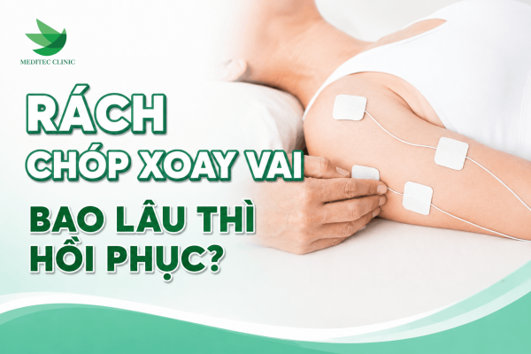 Rách chóp xoay vai bao lâu thì hồi phục?