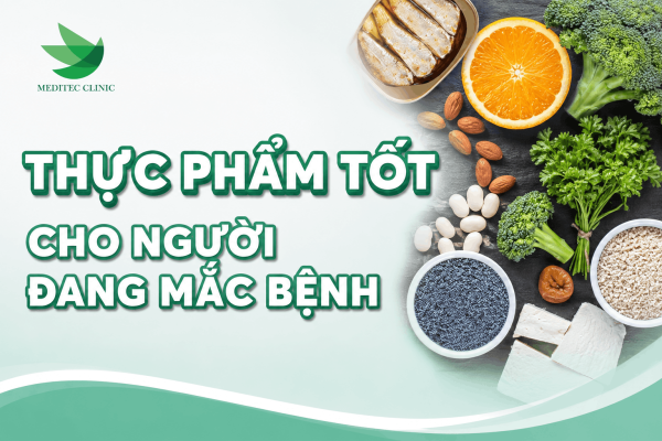 Thực phẩm nào tốt cho người đang mắc bệnh xương khớp?