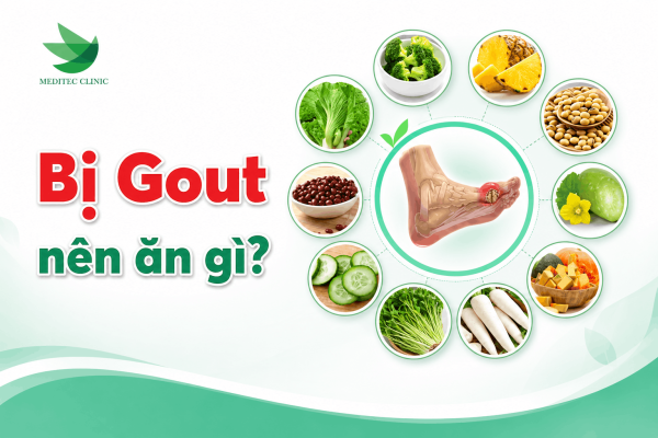 Gout nên ăn gì?