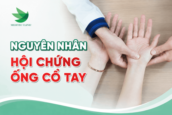 Nguyên nhân và nhóm dễ mắc bệnh