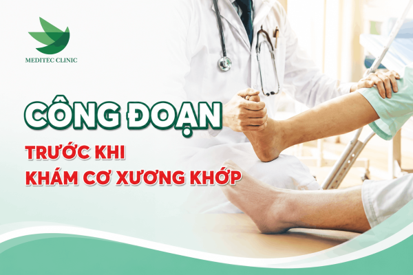 Công đoạn chuẩn bị trước khi khám cơ xương khớp