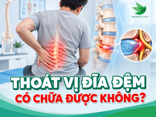 thoát vị đĩa đệm có chữa được không